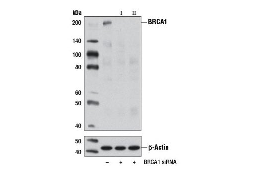 undefined Image 1: SignalSilence<sup>®</sup> BRCA1 siRNA I