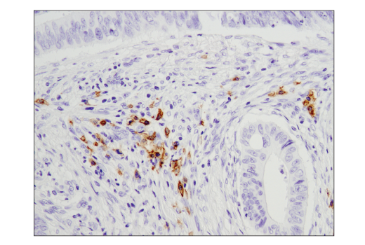 Immunohistochemistry Image 4: CD19 (Intracellular Domain) (D4V4B) XP<sup>®</sup> Rabbit mAb (BSA and Azide Free)