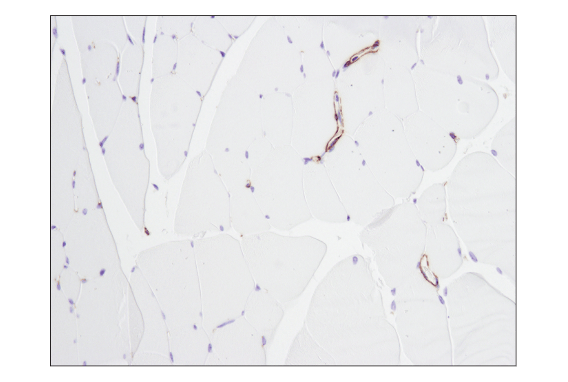Immunohistochemistry Image 7: α-Smooth Muscle Actin (D4K9N) XP<sup>®</sup> Rabbit mAb (BSA and Azide Free)