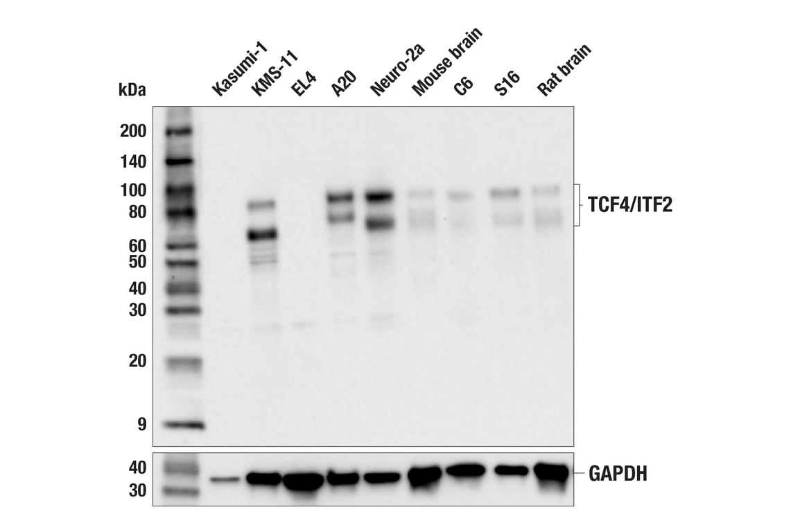 Western Blotting Image 2: TCF4/ITF2 (E3X2Y) Rabbit mAb