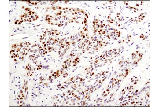 Immunohistochemistry Image 1: PCNA (D3H8P) XP<sup>®</sup> Rabbit mAb 