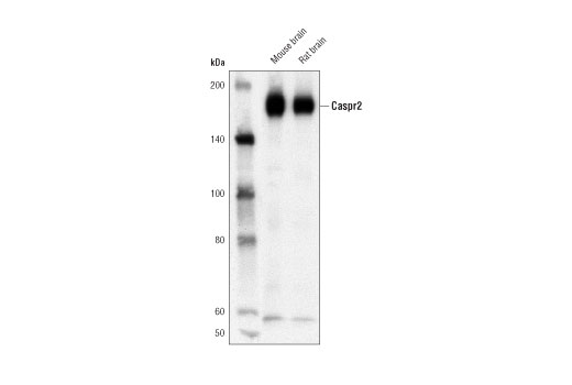 undefined Image 6: Demyelinating Disease Targets Antibody Sampler Kit