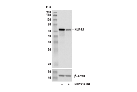 Western Blotting Image 1: NUP62 (E7H9O) Rabbit mAb
