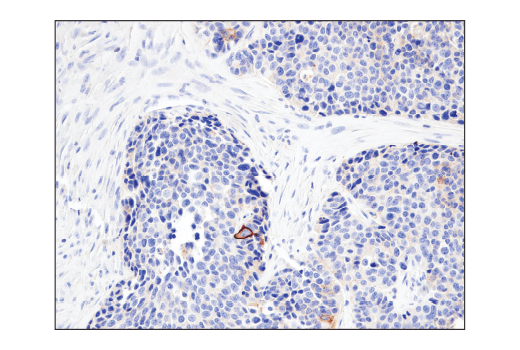 Immunohistochemistry Image 2: CD47 (D3O7P) Rabbit mAb
