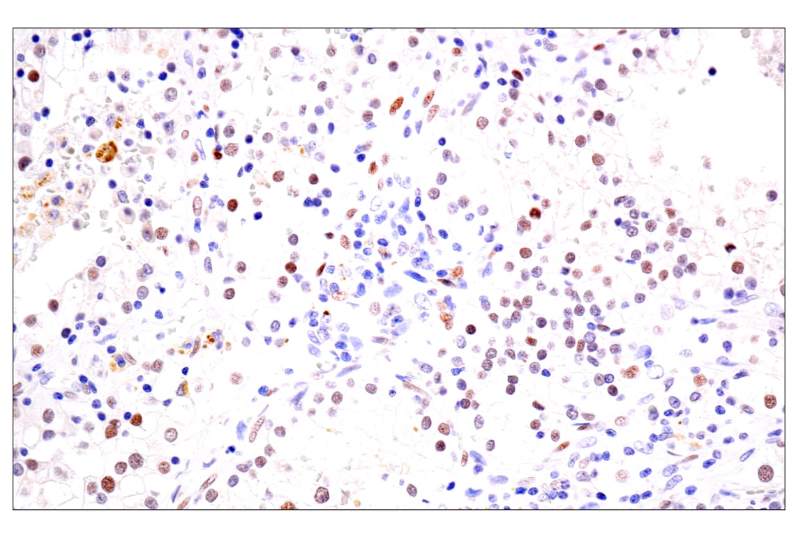 Immunohistochemistry Image 2: BATF3 (E3F3L) Rabbit mAb