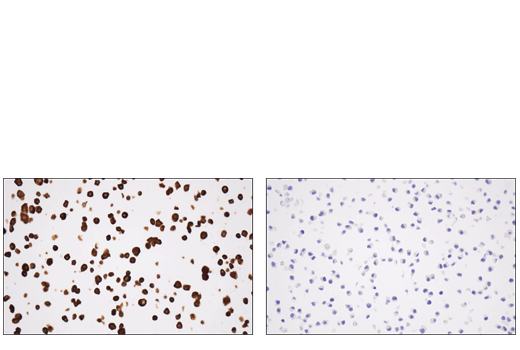 Immunohistochemistry Image 2: Tyrosine Hydroxylase (E2L6M) Rabbit mAb (BSA and Azide Free)