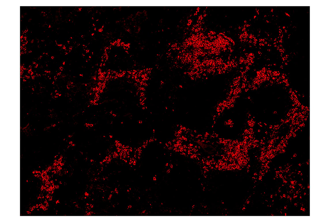 Immunohistochemistry Image 4: CD20 (E7B7T) & CO-0011-750 SignalStar<sup>™</sup> Oligo-Antibody Pair