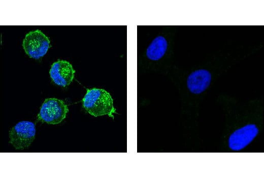 Immunofluorescence Image 1: PDGF Receptor α (D1E1E) XP<sup>®</sup> Rabbit mAb