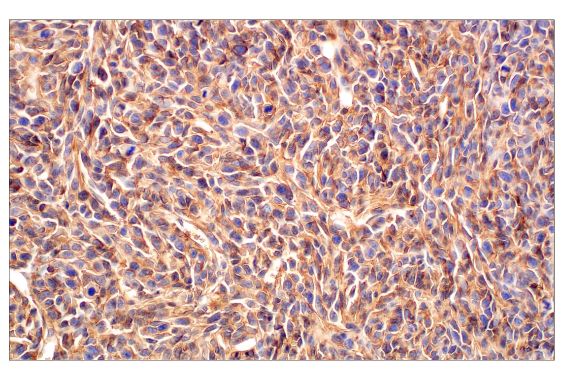 Immunohistochemistry Image 7: CD47 (E2V9V) Rabbit mAb