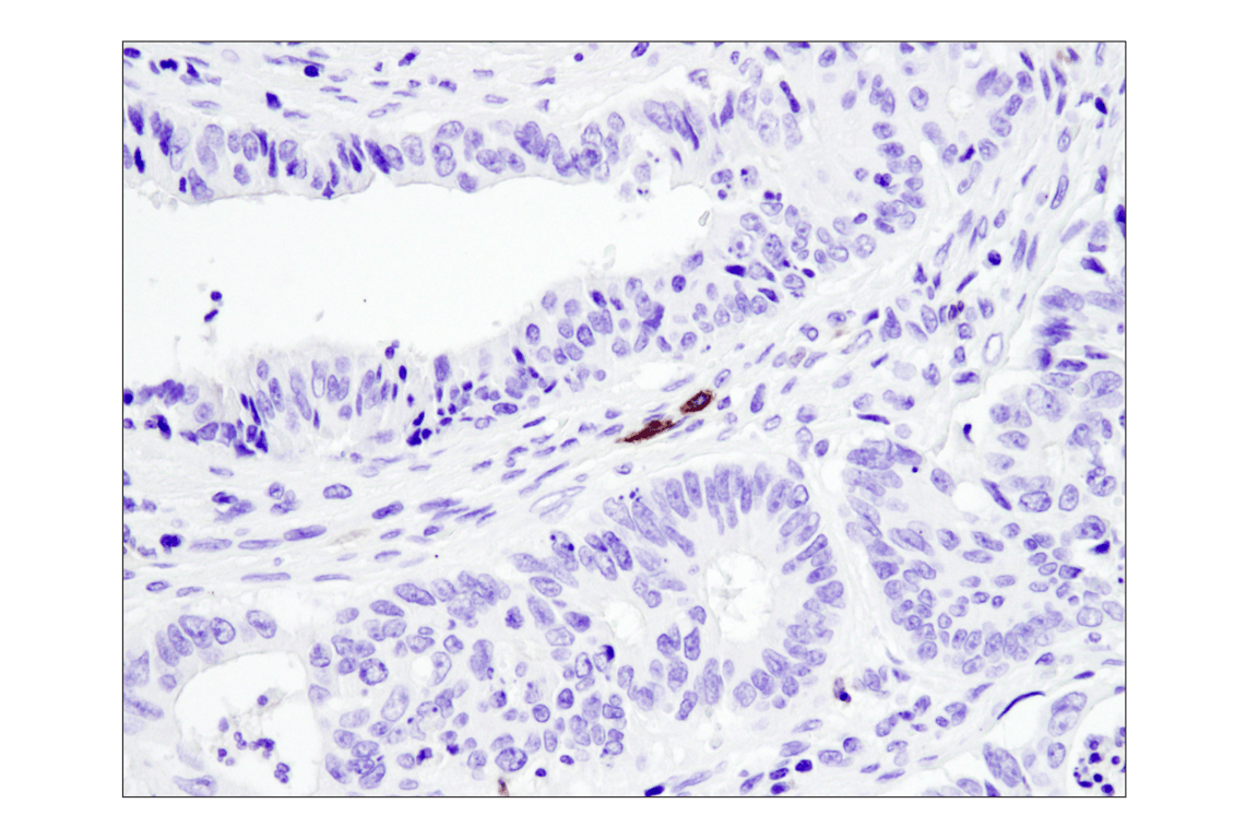 Immunohistochemistry Image 5: TNFRSF8/CD30 (E4L4I) XP<sup>®</sup> Rabbit mAb (BSA and Azide Free)