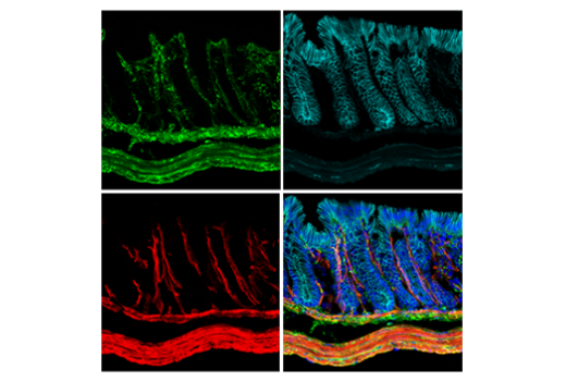 Immunofluorescence Image 3: COL1A1 (E8F4L) XP<sup>®</sup> Rabbit mAb (BSA and Azide Free)