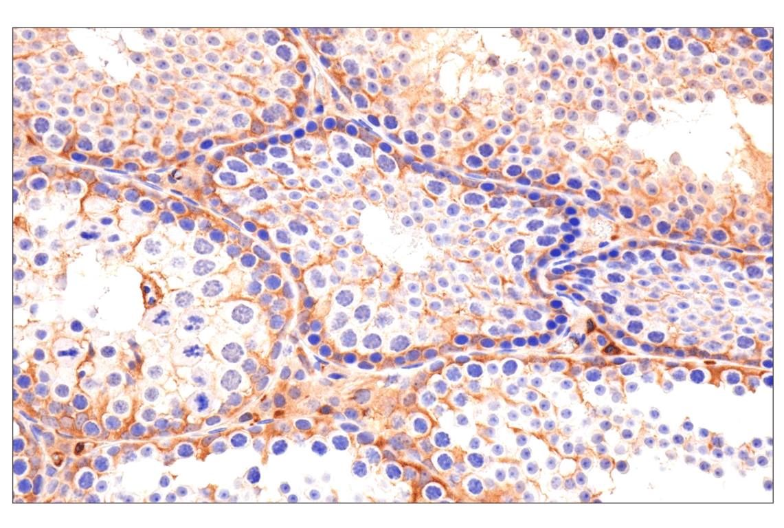 Immunohistochemistry Image 6: Caspase-8 (F5K9P) Rabbit mAb (BSA and Azide Free)