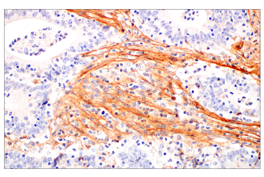 undefined Image 35: Extracellular Matrix Dynamics Antibody Sampler Kit
