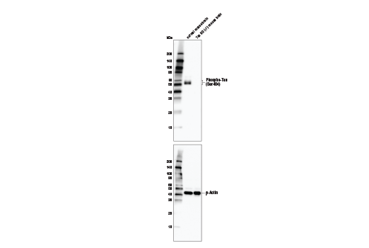 Western Blotting Image 1: Phospho-Tau (Ser404) (D2Z4G) Rabbit mAb