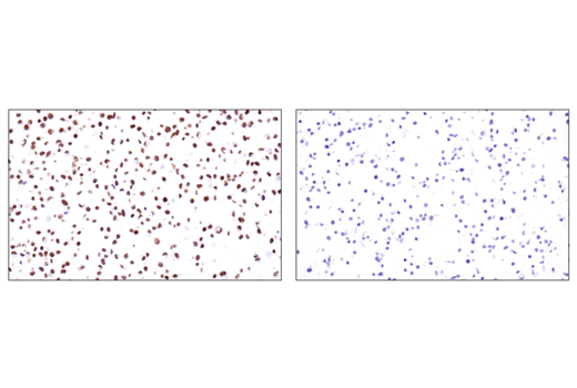 undefined Image 67: Epithelial-Mesenchymal Transition (EMT) IF Antibody Sampler Kit