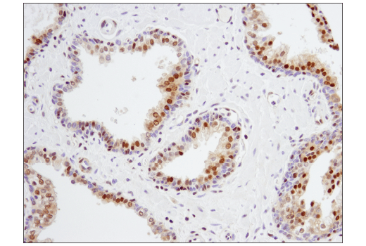 Immunohistochemistry Image 5: p27 Kip1 (SX53G8.5) Mouse mAb (IHC Formulated)