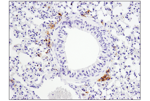 Immunohistochemistry Image 1: FcγRIIB (D8F9C) XP<sup>®</sup> Rabbit mAb