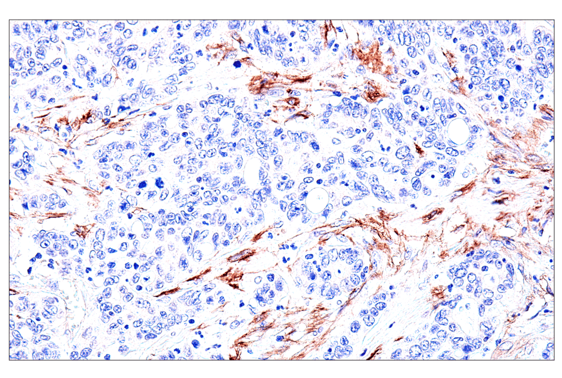 Immunohistochemistry Image 8: FAP (F1A4G) Rabbit mAb