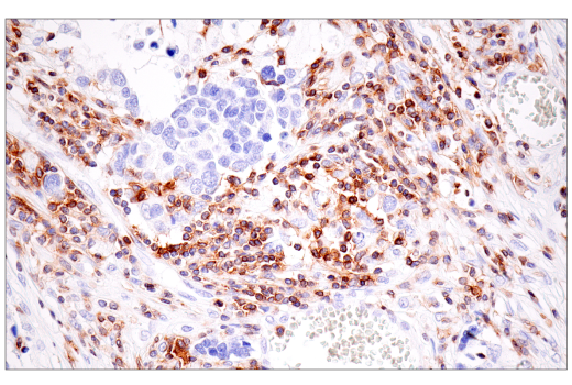 Immunohistochemistry Image 8: SLAMF6/CD352 (E3H1E) XP<sup>®</sup> Rabbit mAb (BSA and Azide Free)