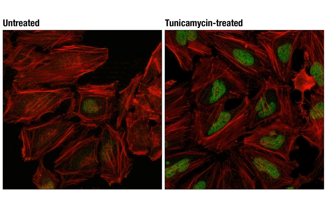 Immunofluorescence Image 1: ATF-4 (D4B8) Rabbit mAb