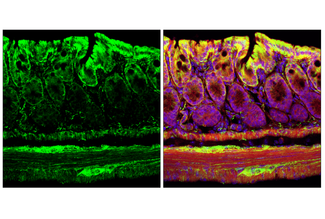 Immunofluorescence Image 1: Hexokinase I (C35C4) Rabbit mAb (BSA and Azide Free)