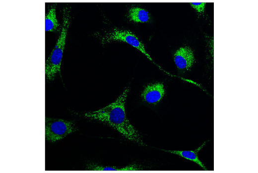 Immunofluorescence Image 1: Cathepsin D (E7Z4L) XP<sup>®</sup> Rabbit mAb