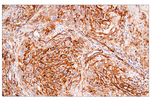 Immunohistochemistry Image 1: CD141/Thrombomodulin (E7Y9P) XP<sup>®</sup> Rabbit mAb (BSA and Azide Free)