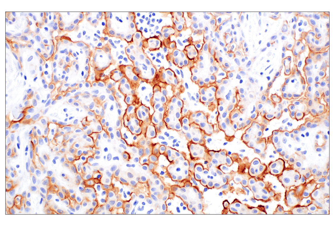 Immunohistochemistry Image 1: UPK3B (DBRRM3.66) Rabbit mAb