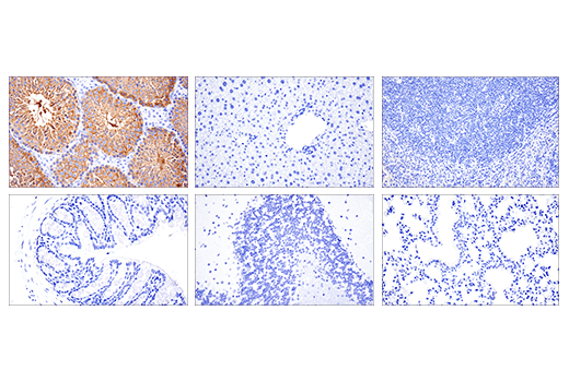 Immunohistochemistry Image 2: Ly6k (E4K8Y) XP<sup>®</sup> Rabbit mAb