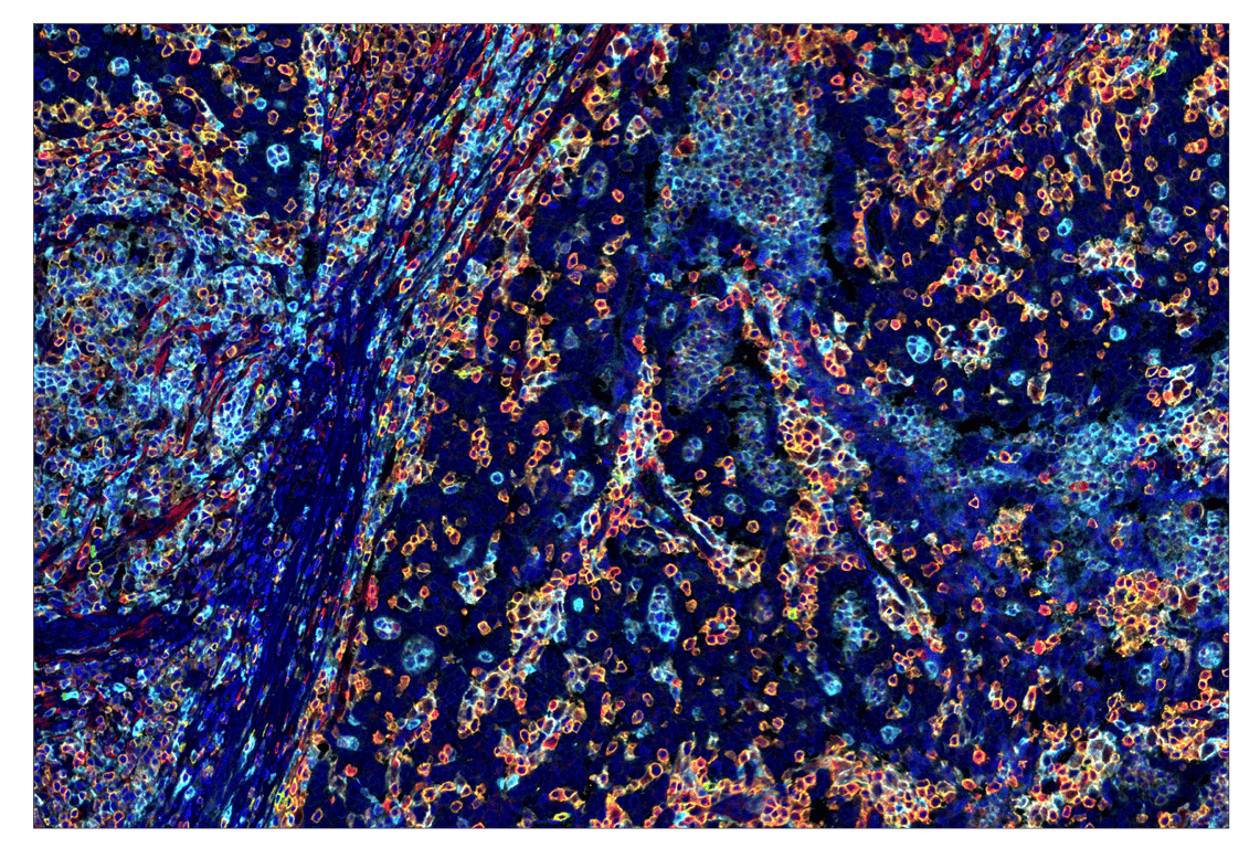 Immunohistochemistry Image 1: Phospho-SLP-76 (Ser376) (E3G9U) & CO-0018-488 SignalStar<sup>™</sup> Oligo-Antibody Pair