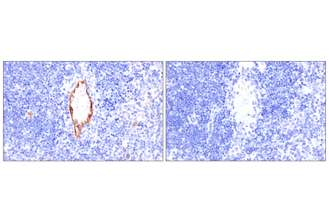 Immunohistochemistry Image 6: ESAM (F9D9P) Rabbit mAb