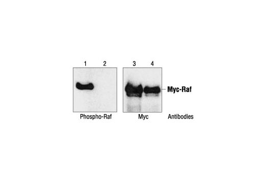undefined Image 38: Phospho-Akt Pathway Antibody Sampler Kit
