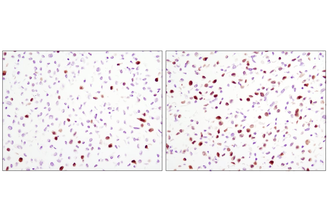 Immunohistochemistry Image 3: Phospho-p44/42 MAPK (Erk1/2) (Thr202/Tyr204) (D13.14.4E) XP<sup>®</sup> Rabbit mAb