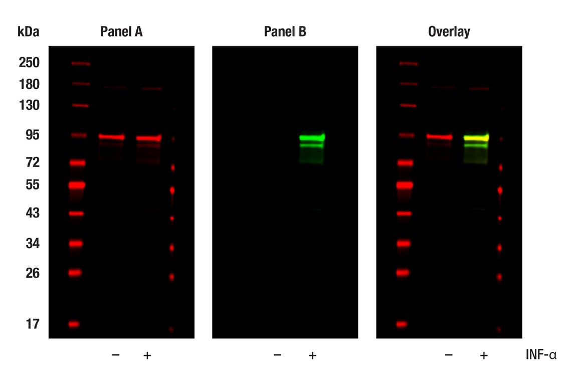 undefined Image 61: ALK Activation Antibody Sampler Kit