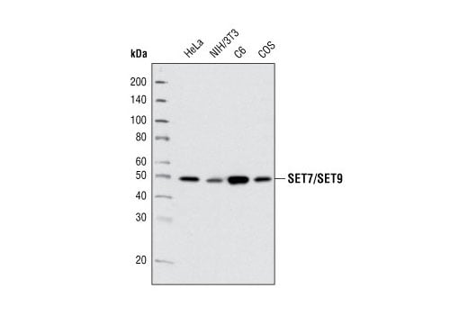 Western Blotting Image 1: SET7/SET9 (C24B1) Rabbit mAb