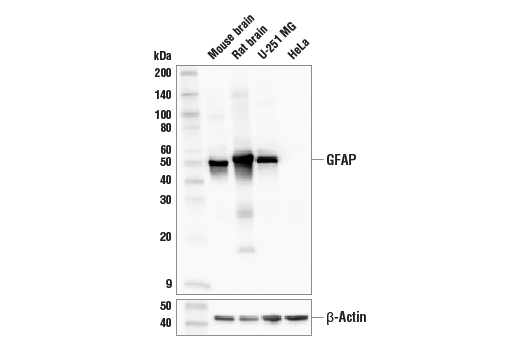 Western Blotting Image 1: GFAP (E8S7G) Mouse mAb (BSA and Azide Free)