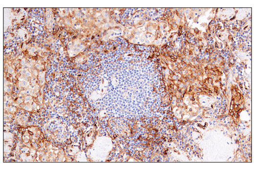 Immunohistochemistry Image 3: CD141/Thrombomodulin (E7Y9P) XP<sup>®</sup> Rabbit mAb