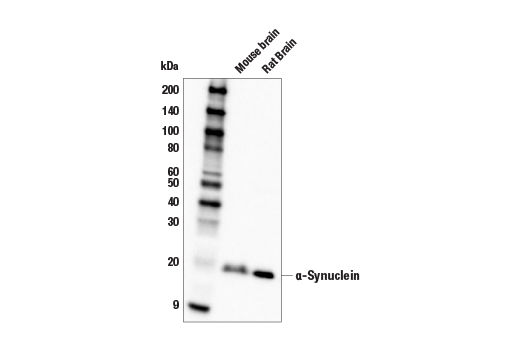 Western Blotting Image 1: α-Synuclein (E4U2F) XP<sup>®</sup> Rabbit mAb (BSA and Azide Free)