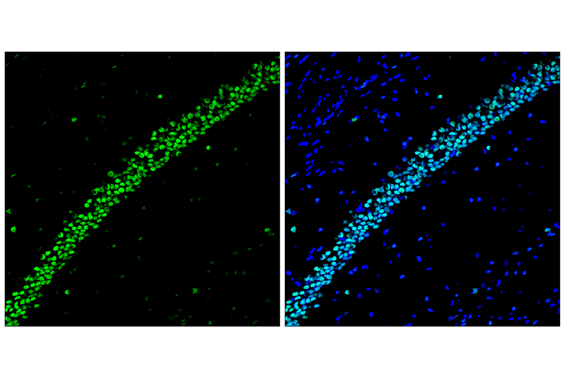 Immunofluorescence Image 2: TCF4/ITF2 (E3X2Y) Rabbit mAb