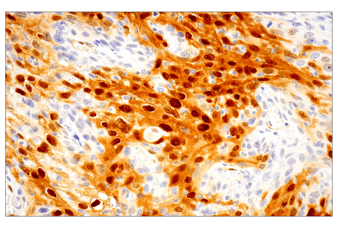undefined Image 29: Cannabinoid Receptor 1 Downstream Signaling Antibody Sampler Kit