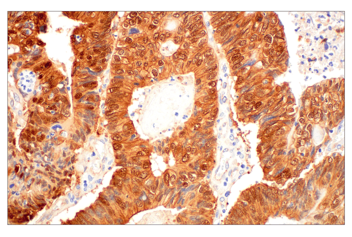 undefined Image 36: Cadherin-Catenin Antibody Sampler Kit