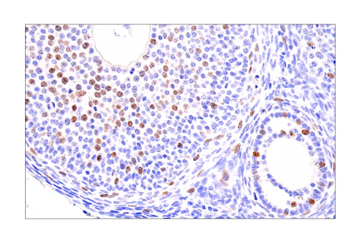 Immunohistochemistry Image 5: ATAD2 (E8Y7F) Rabbit mAb