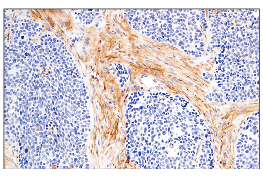 Immunohistochemistry Image 4: CD54/ICAM-1 (E3Q9N) XP<sup>®</sup> Rabbit mAb (BSA and Azide Free)