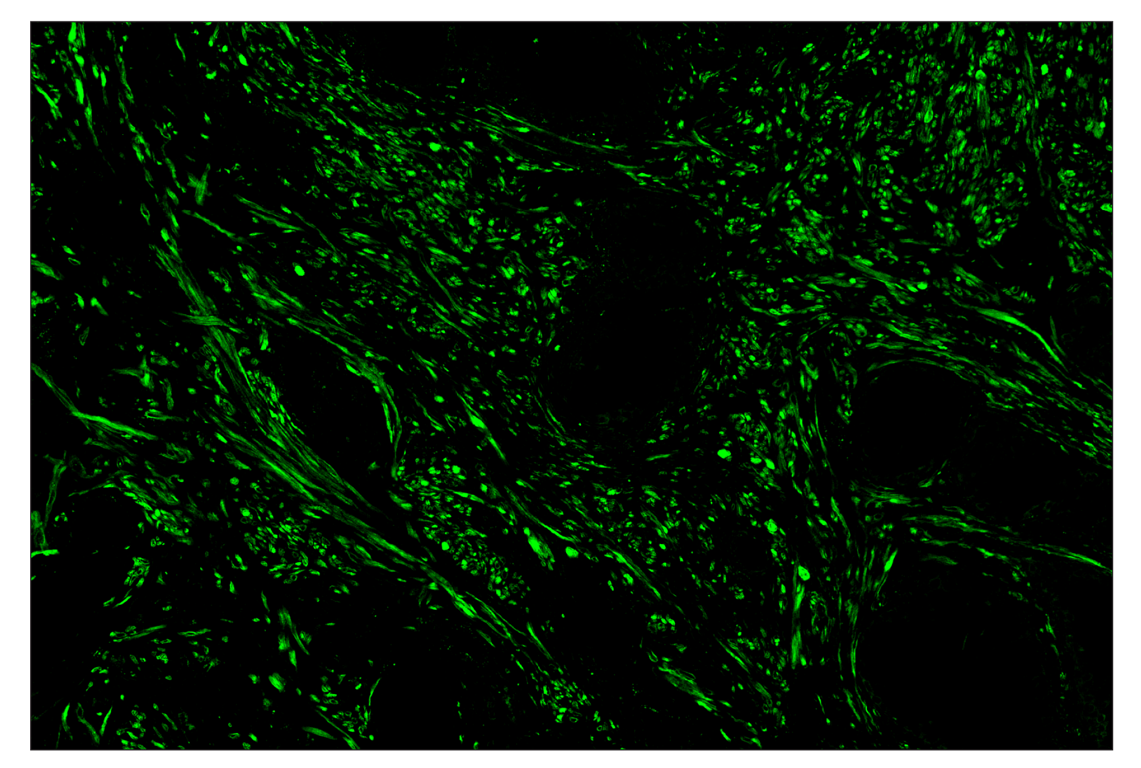 Immunohistochemistry Image 2: OX40L (D6K7R) & CO-0087-594 SignalStar<sup>™</sup> Oligo-Antibody Pair