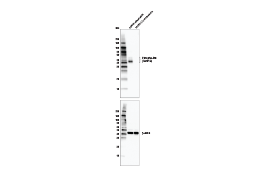 Western Blotting Image 3: Phospho-Tau (Ser416) (D7U2P) Rabbit mAb (BSA and Azide Free)