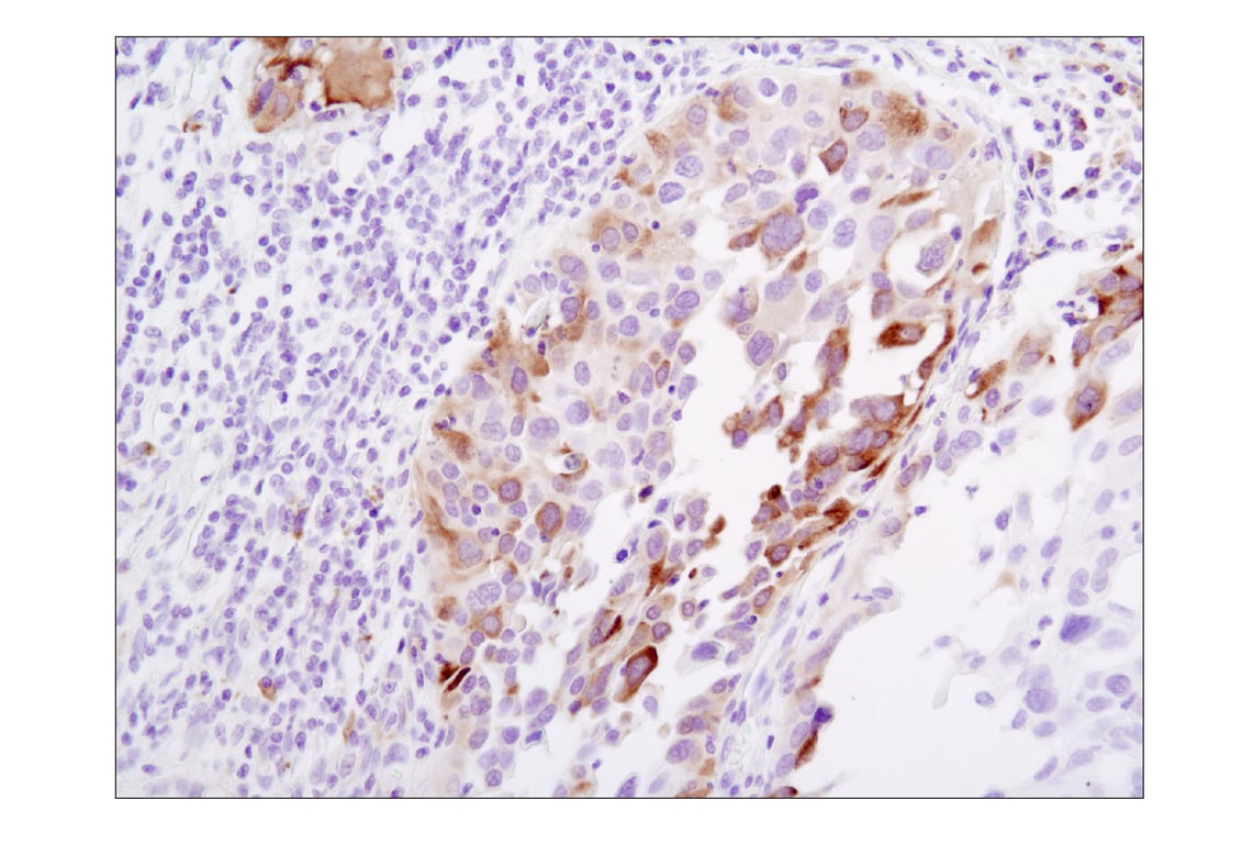 Immunohistochemistry Image 2: Phospho-S6 Ribosomal Protein (Ser235/236) (D57.2.2E) XP<sup>®</sup> Rabbit mAb (BSA and Azide Free)