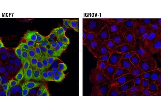 Immunofluorescence Image 1: AGR2 (D9V2F) XP<sup>®</sup> Rabbit mAb (BSA and Azide Free)