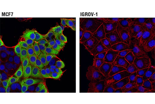 Immunofluorescence Image 1: AGR2 (D9V2F) XP<sup>®</sup> Rabbit mAb (BSA and Azide Free)