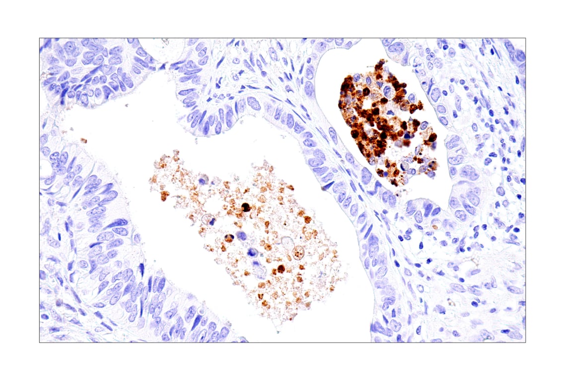 Immunohistochemistry Image 1: IL-8 (E5F5Q) XP<sup>®</sup> Rabbit mAb