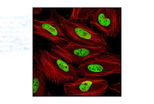 undefined Image 35: Microglia Proliferation Module Antibody Sampler Kit